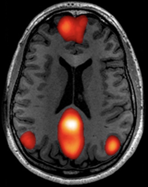 功能磁共振（fMRI）数据处理业务